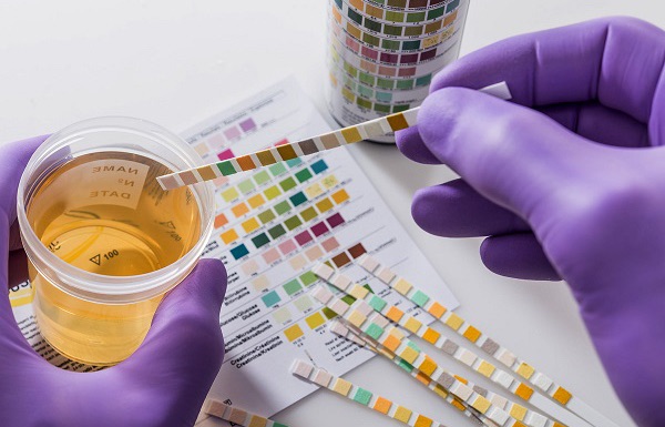 FG mandates drug tests for secondary school&nbsp;students.