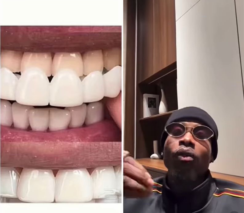 You can’t have sparkling white teeth and still have bad breath” — Nightlife Influencer Yhemolee speaks on veneers and&nbsp;hygiene
