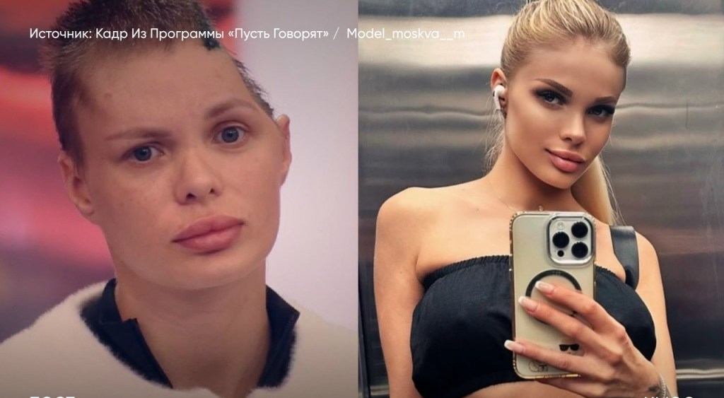 Businessman who beat his girlfriend&nbsp;so severely she lost half her skull d!es from shock after learning he would be jailed or must go fight in&nbsp;Ukraine